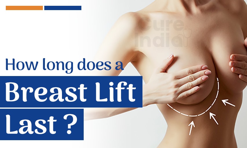 How long does a breast lift last, and what factors affect it?